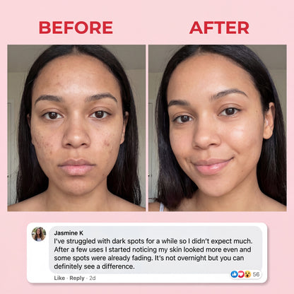 Dr.Melaxin Overnight Mask
